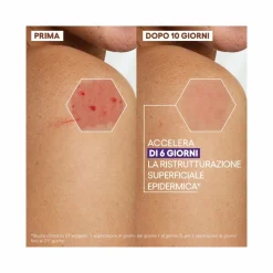 A-Derma Epitheliale Ultra Repair HA+ Crema Ristrutturante Anti-Segni Residui 100ml