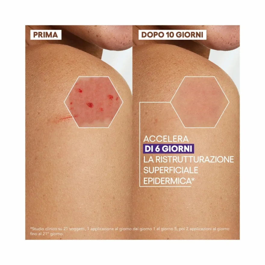 A-Derma Epitheliale Ultra Repair HA+ Crema Ristrutturante Anti-Segni Residui 100ml