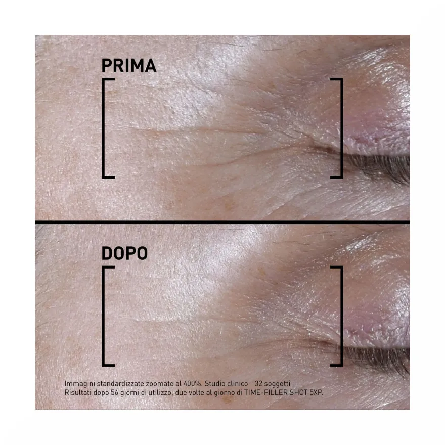 Filorga Time Filler Shot 5xp Siero Concentrato Linee Di Espressione 15ml