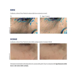 Helan Ireos Contorno Occhi Siero Gel Liftante Illuminante Antiborse Antiocchiaie 10ml