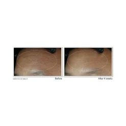 Roc Retinol Correxion Line Smoothing Max Hydration Crema Viso 50ml