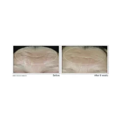 Roc Retinol Correxion Line Smoothing Max Hydration Crema Viso 50ml