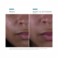 SkinCeuticals Silymarin CF Siero Antiossidante con Vitamina C Pura Ideale per Pelli Grasse 30ml