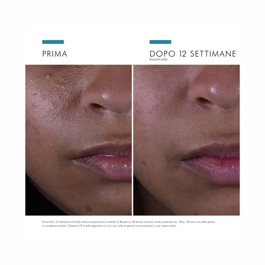 SkinCeuticals Silymarin CF Siero Antiossidante con Vitamina C Pura Ideale per Pelli Grasse 30ml