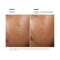 Skinceuticals Trattamento Idratante Lenitivo Viso 30ml