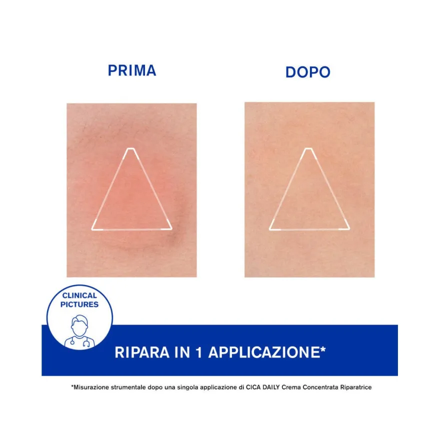 Uriage Cica Daily Crema Concentrata Riparatrice 50ml