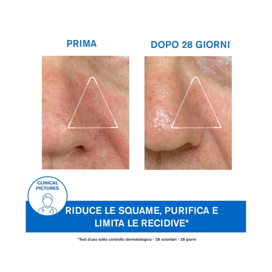 Uriage DS Emulsione 40ml