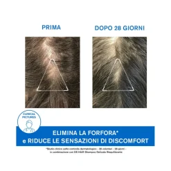 Uriage DS Hair Trattamento Antiforfora 200ml
